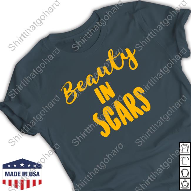 Kechi Beauty In Scars Shirt